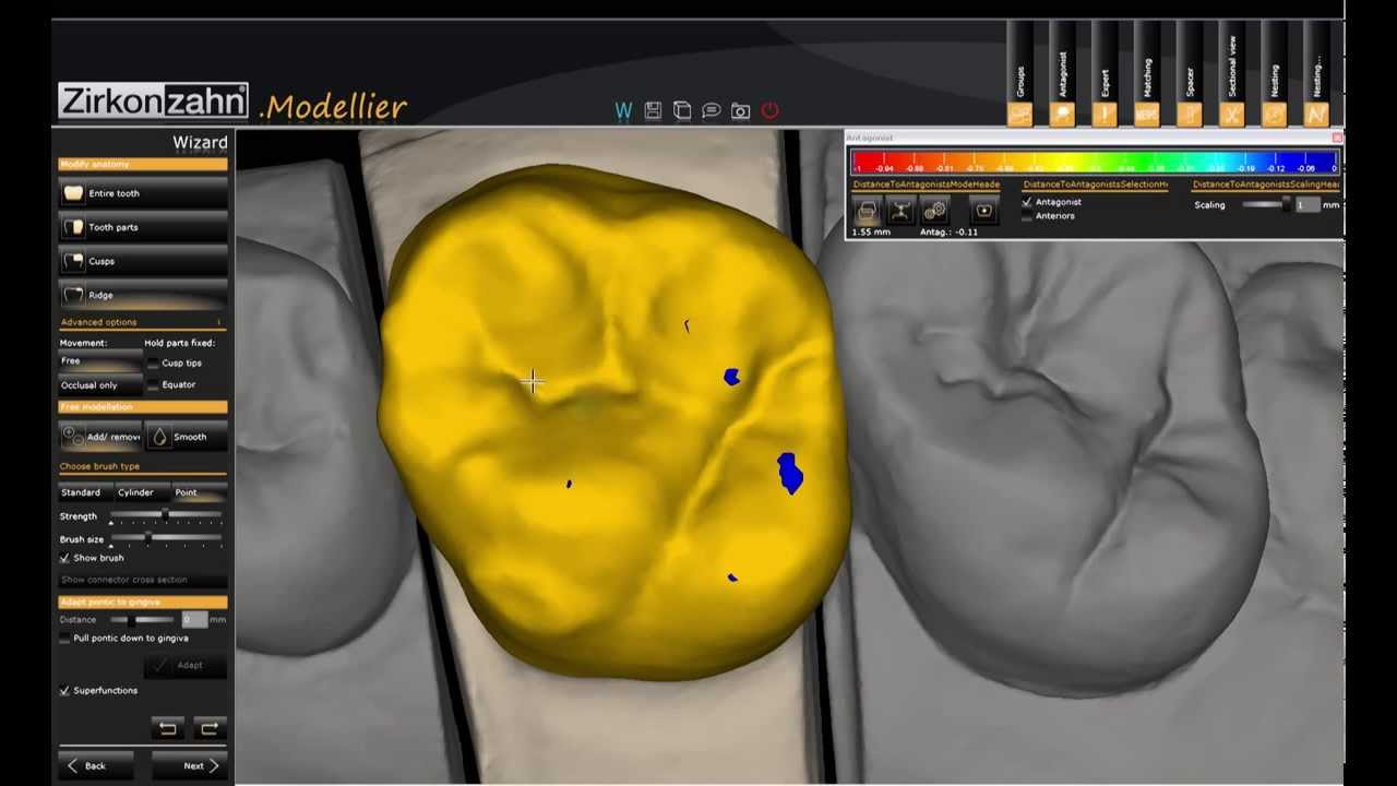 Zirkonzahn CAD CAM Software   Zirkonzahn Modellier 1