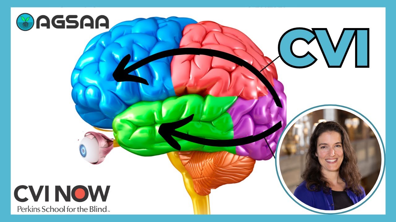 Unlocking Insights: Understanding and Awareness on Cerebral/Cortical Visual Impairment (CVI Now)