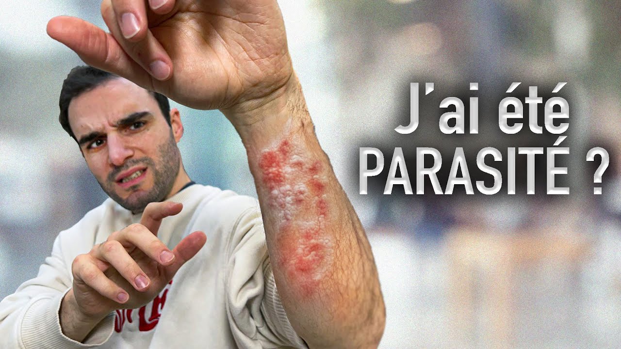 J'ai été parasité ?