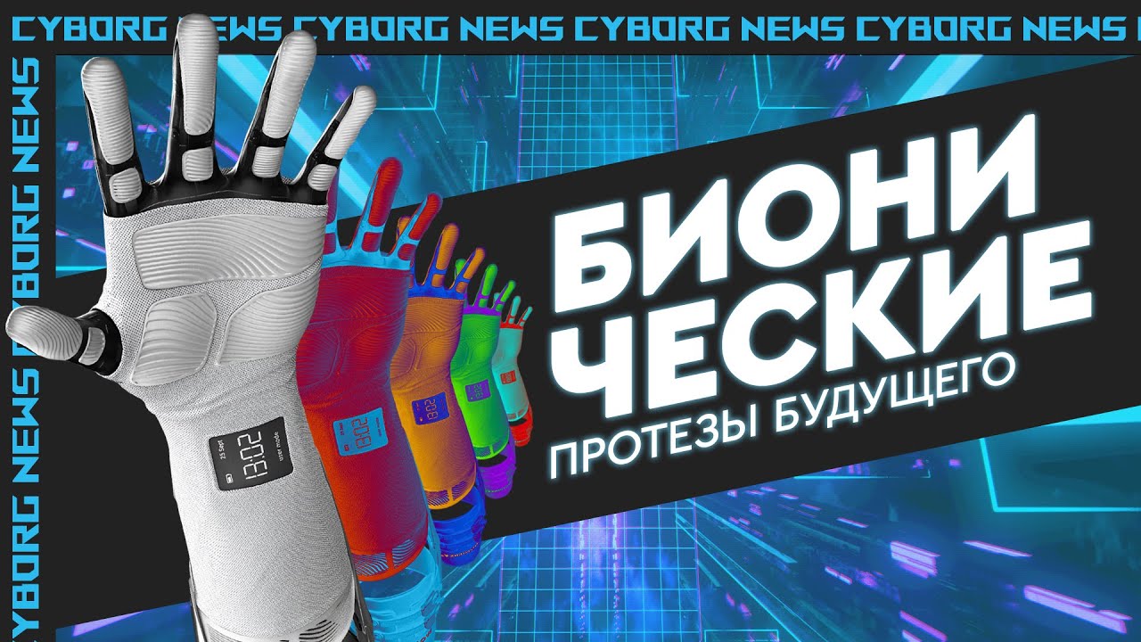 ВЛОГ: ЛЮДИ КИБОРГИ Как управляются бионические протезы.