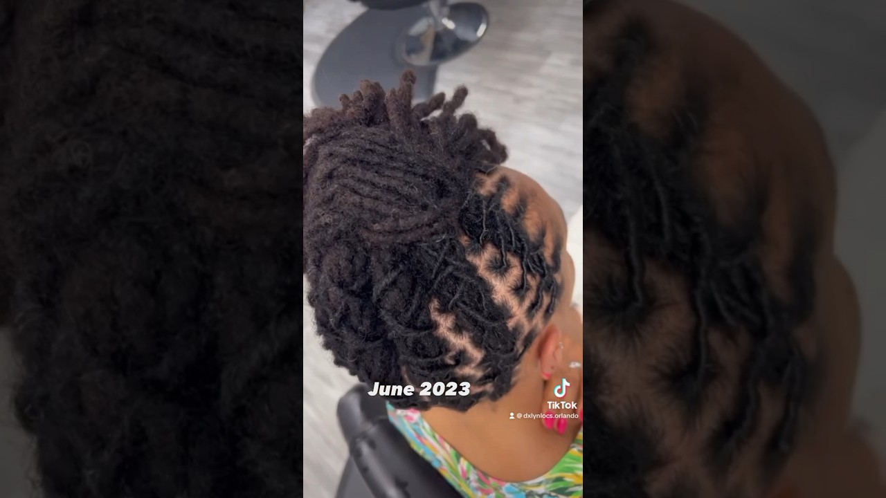 3 year Instant loc journey | Before and after