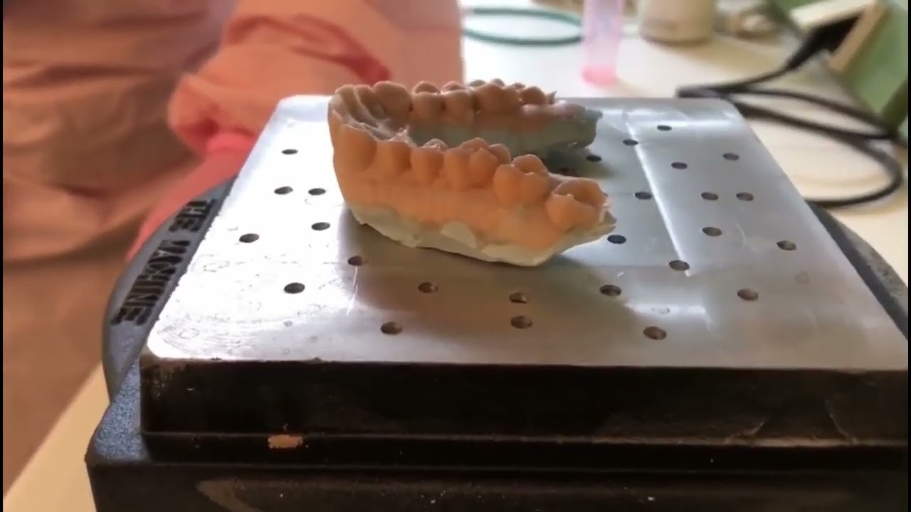 Using Parkell's Blu Mousse® and Mach® to Make Whitening Trays Chairside