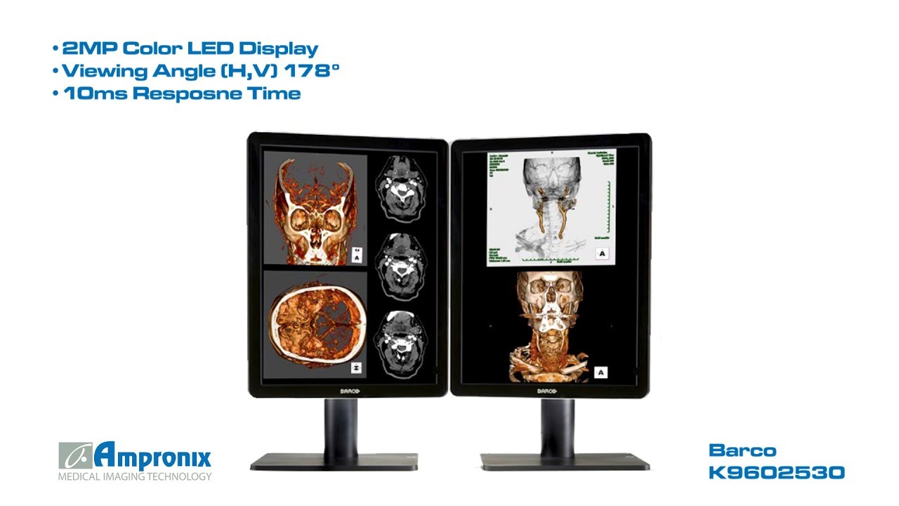 Barco Nio MDNC-2221 (K960253) Display Monitor Sales | Service | Repair | Exchange | Replacement