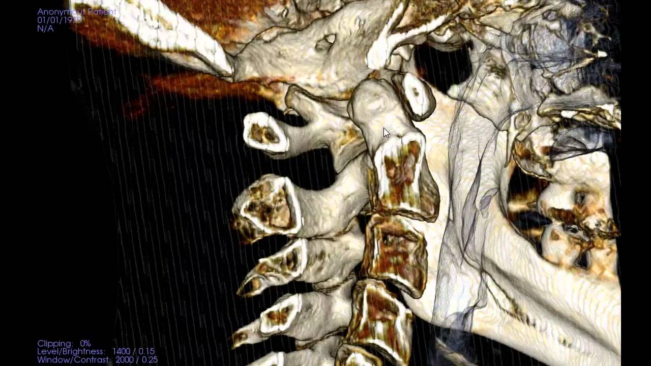 Cutting edge 3D X-ray at OC Upper Cervical Chiropractic in Fullerton, CA