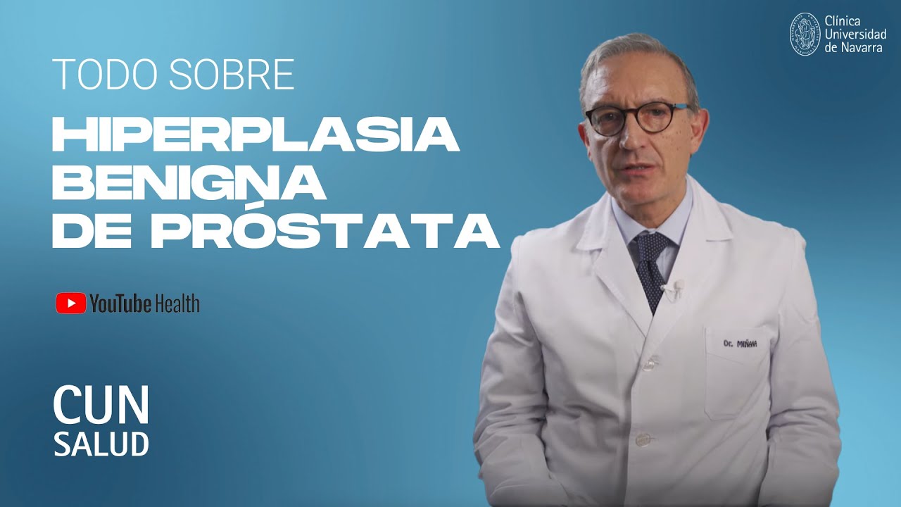 Hiperplasia Benigna de Pr&oacute;stata. Cl&iacute;nica Universidad de Navarra