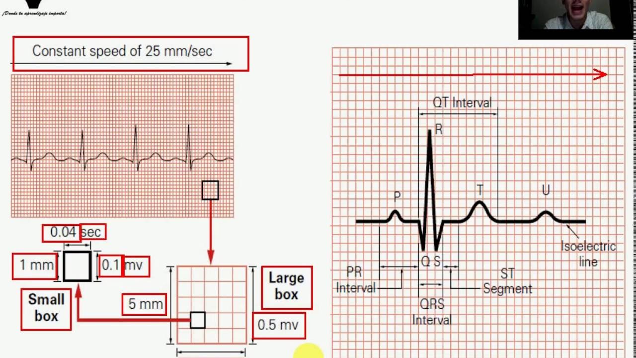 Generalidades del ECG