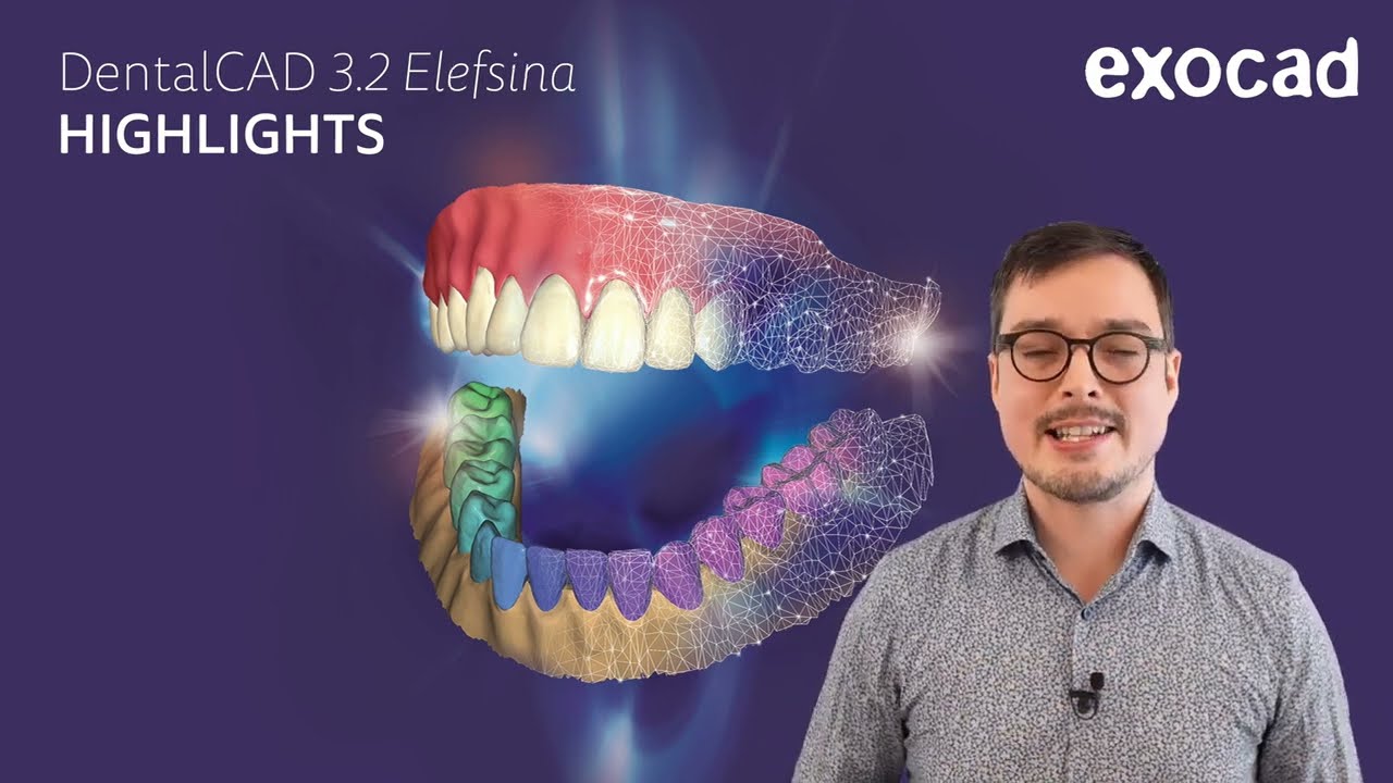 DentalCAD 3 2 Elefsina, highlights video
