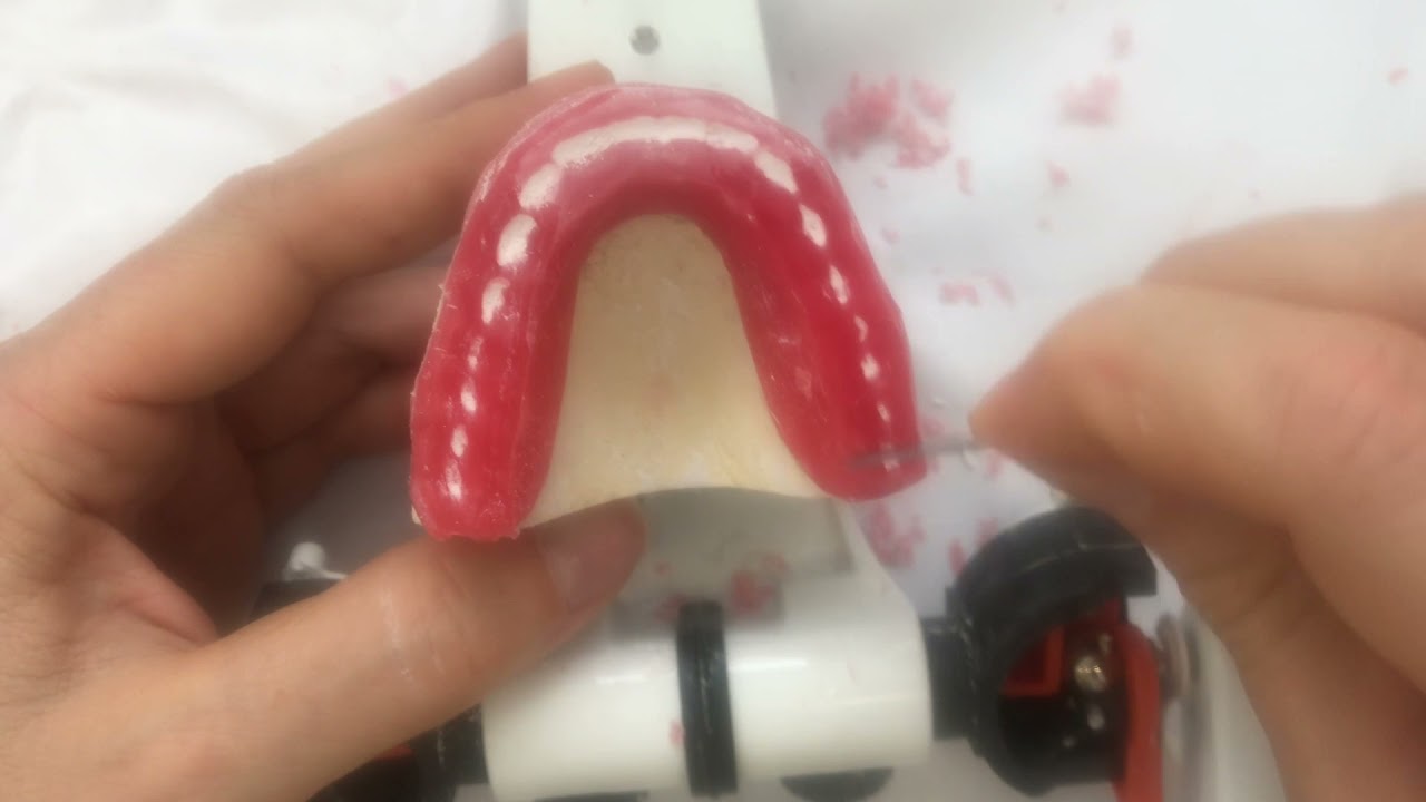 Enceramento de placa oclusal lisa