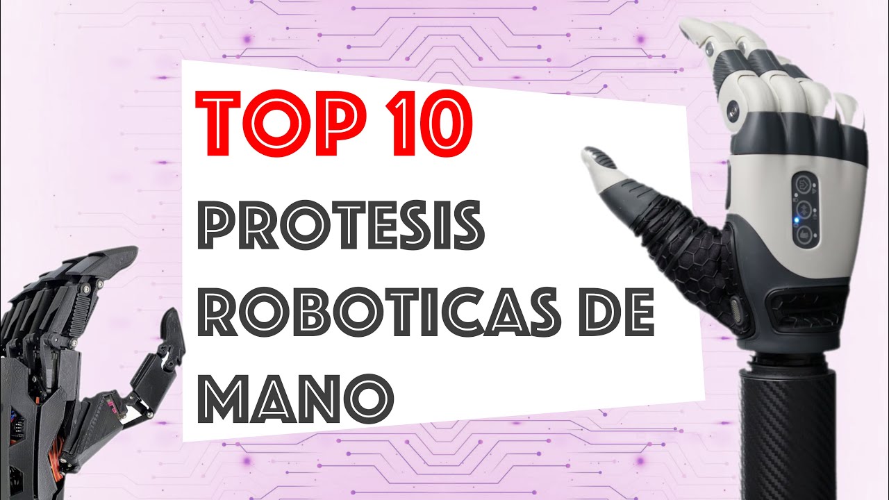 Top 10 Protesis Roboticas de Mano