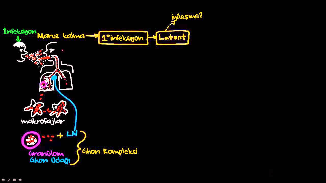 Verem Patogenezi (Sağlık: Verem) (Bulaşıcı Hastalıklar)