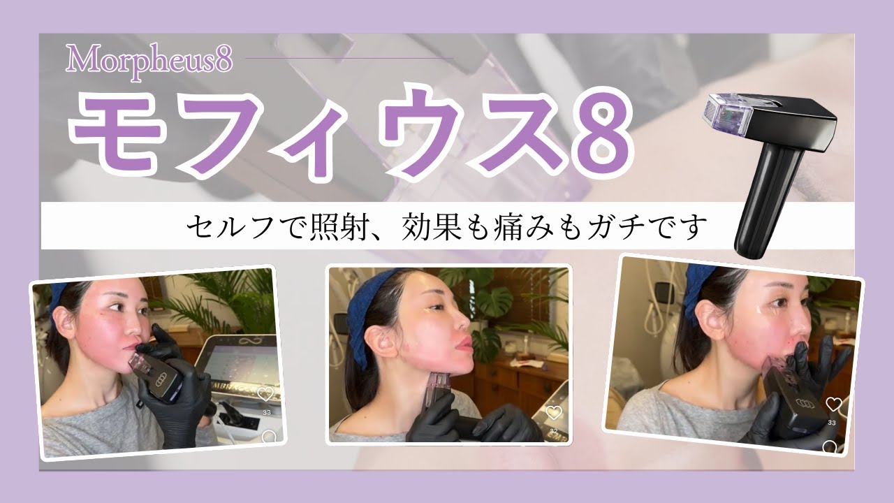 Morpheus8 × セルフ施術｜美容のプロが選ぶ“本当に効く”治療
