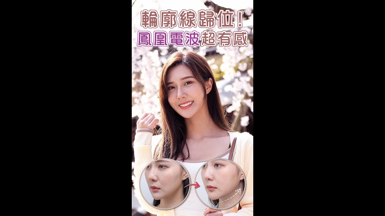 模特兒羽晴的美麗秘密 輪廓定位 | 鳳凰電波  | 黃瑋薇醫師 | 淨妍醫美