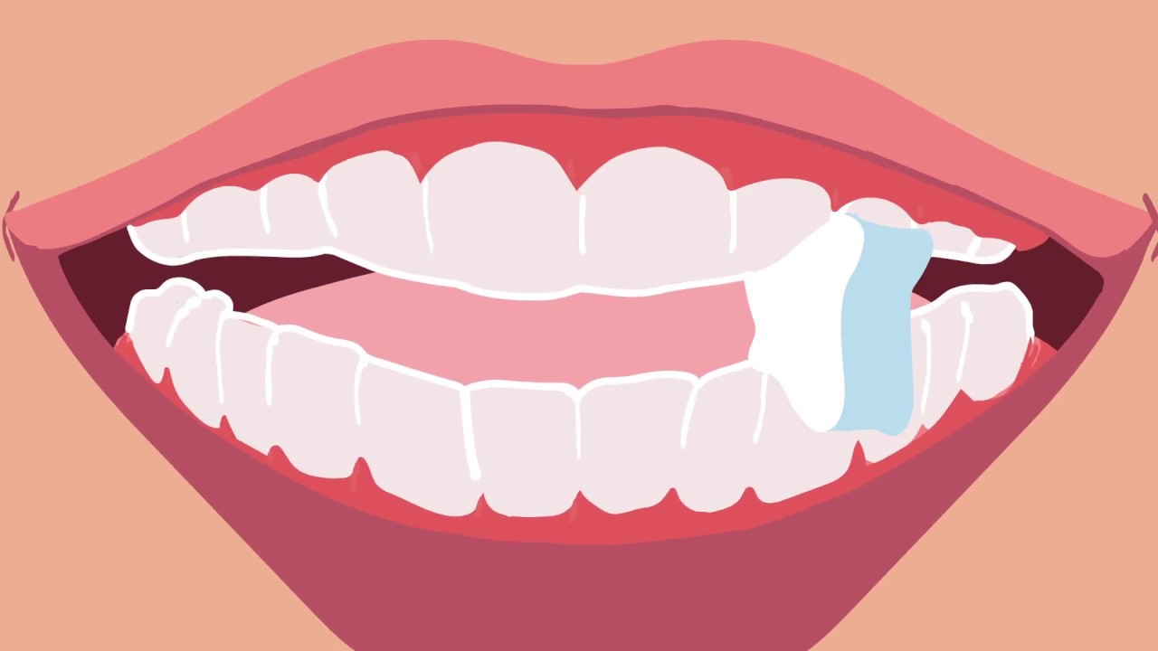 Movemints, the Mint that Fits™ Your Clear Aligners!