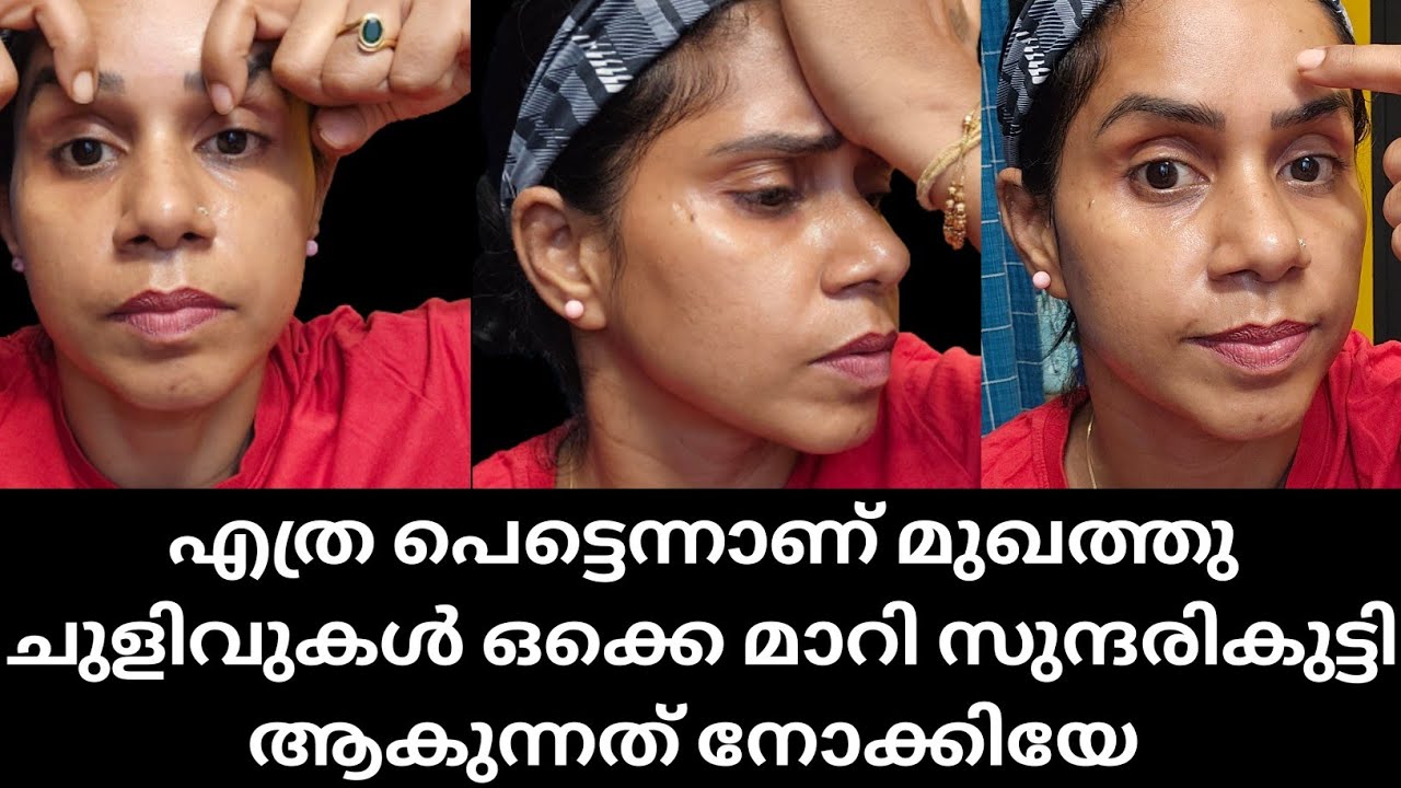50 വയസ്സിലും 30 തോന്നണമെങ്കിൽ BOTOX അല്ല വേണ്ടത് ദിവസവും FACEMASSAGE ചെയ്യൂ | FOREHEAD WRINKLES