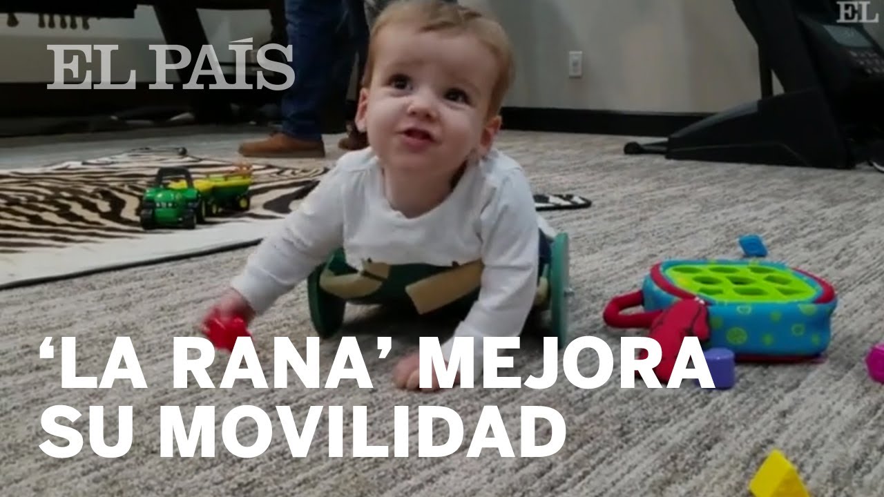 Un bebé con espina bífida consigue moverse con libertad gracias al invento de sus padres