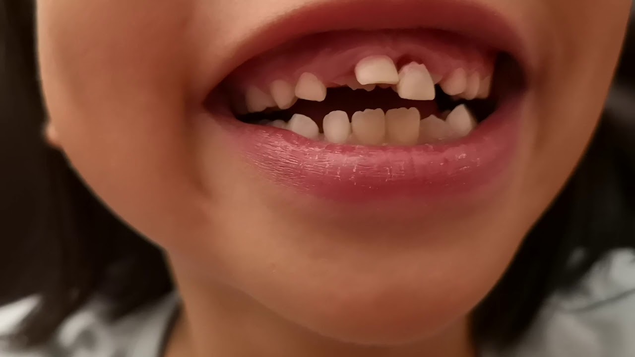Check this loose tooth