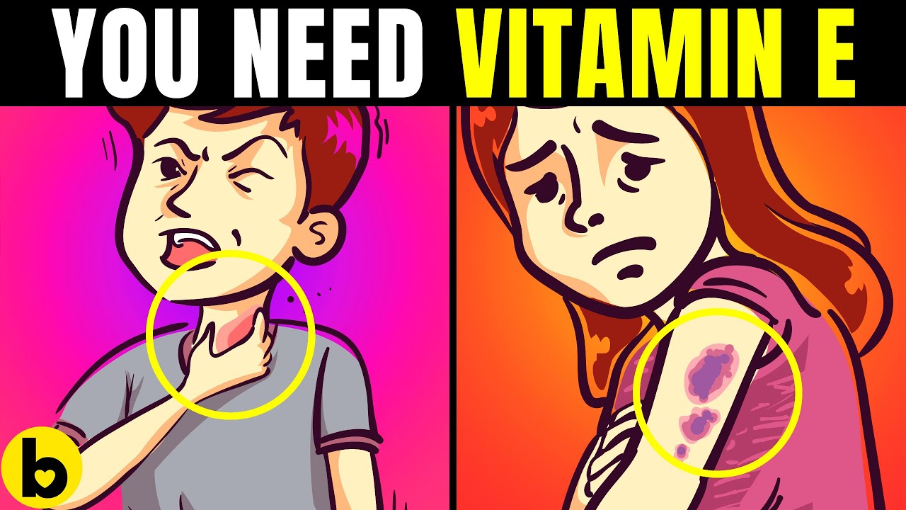 Do You Really Need Vitamin E Supplements?
