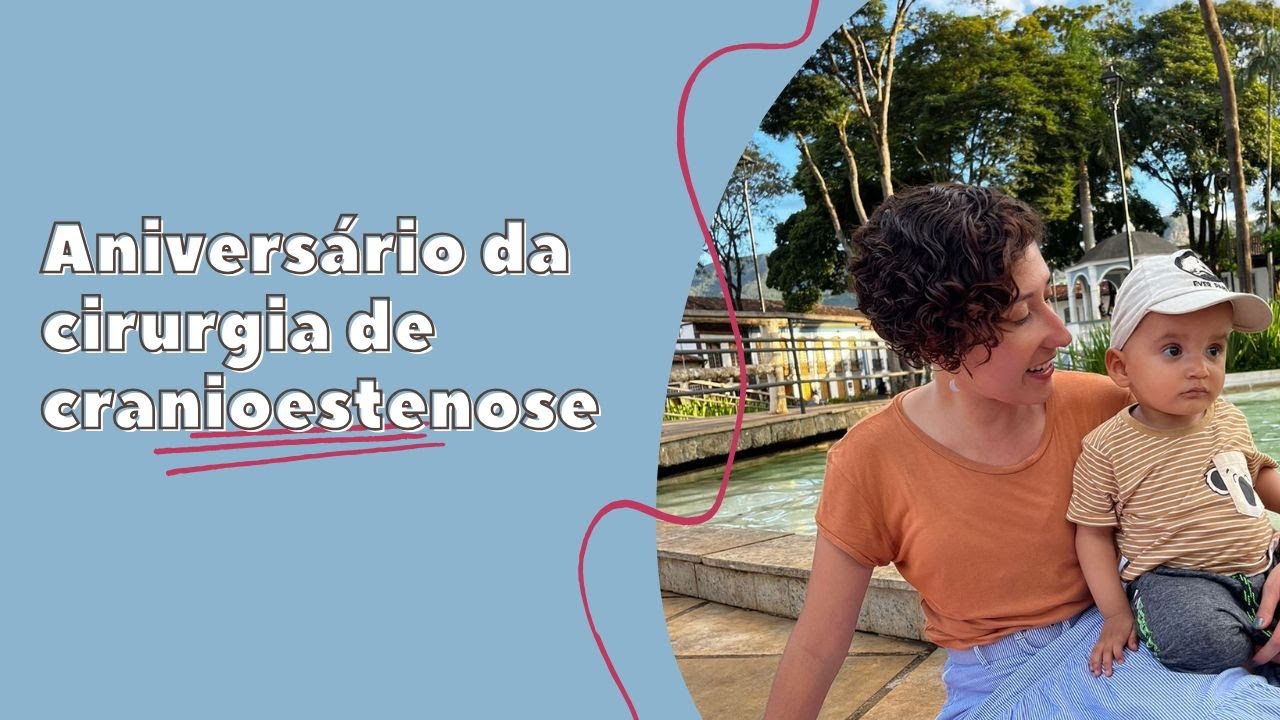 Cranioestenose: Como tem sido 3 anos pós-cirurgia | Gabe Pinheiro