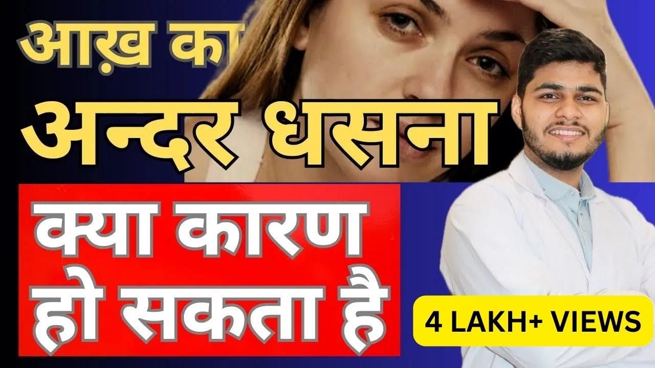 आखों का अंदर धंसना । vitamin defeciency in eyes | trauma eye |aakh ka andar jana