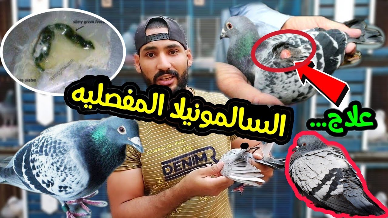علاج مرض السالمونيلا المفصليه (الباراتيفويد) والحاله قبل وبعد العلاج