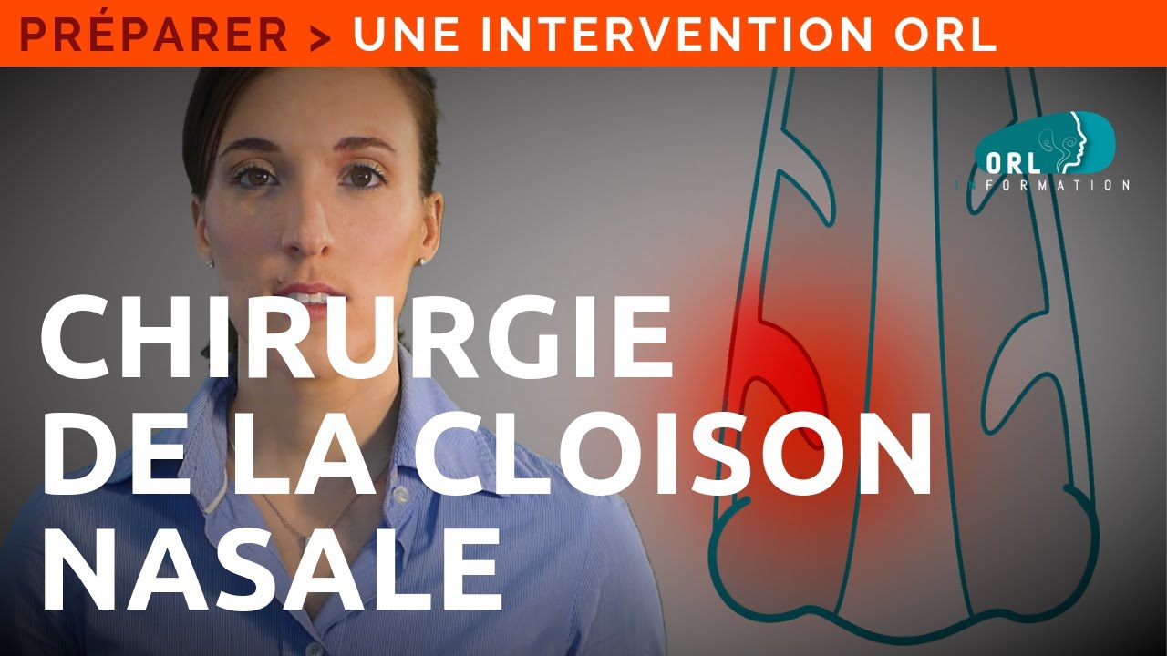 Chirurgie de la cloison du nez (septoplastie) | Information Patient ORL
