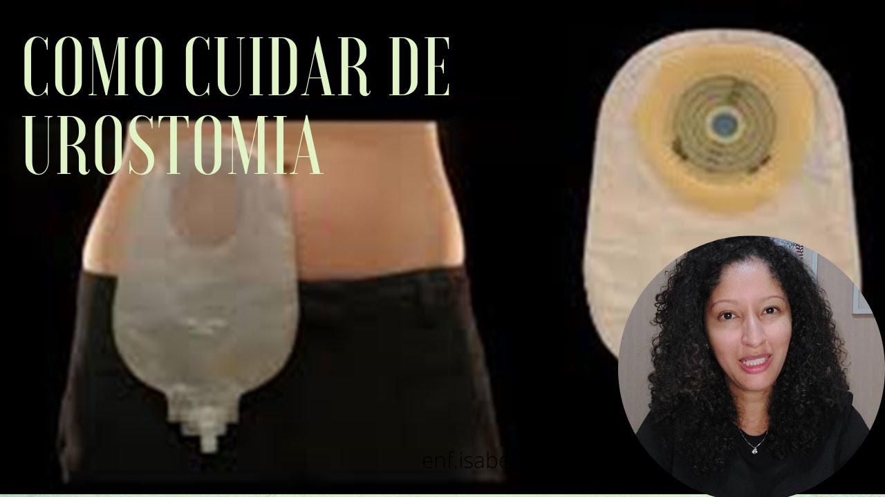 Como cuidar de urostomia