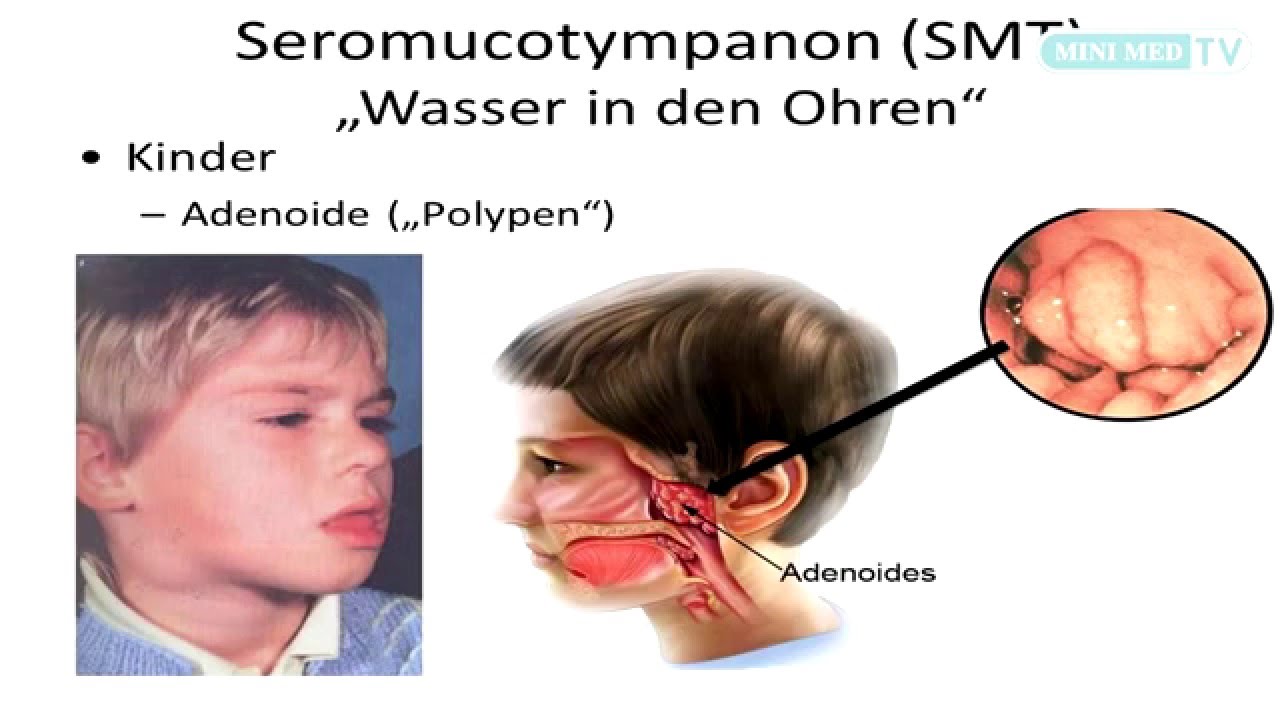 H&ouml;rsinn & H&ouml;rst&ouml;rungen - MINI MED Studium mit Assoc. Prof. Priv.-Doz. Dr. Christoph Arnoldner