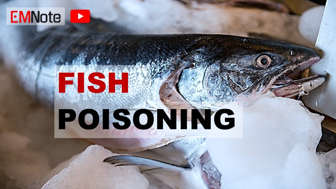 Scombroid and Ciguatera Poisoning