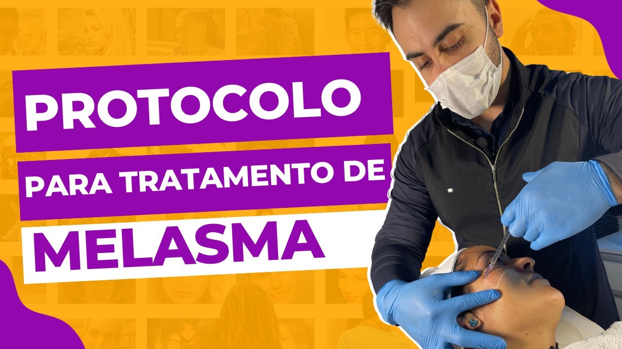 PROTOCOLO PARA MELASMA