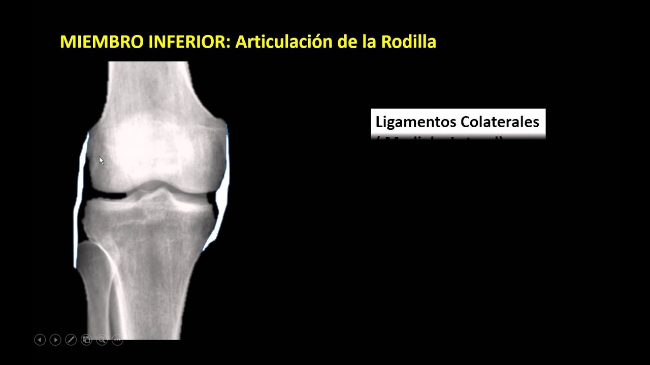 ANATOMÍA RADIOLÓGICA DEL MIEMBRO INFERIOR PARTE II