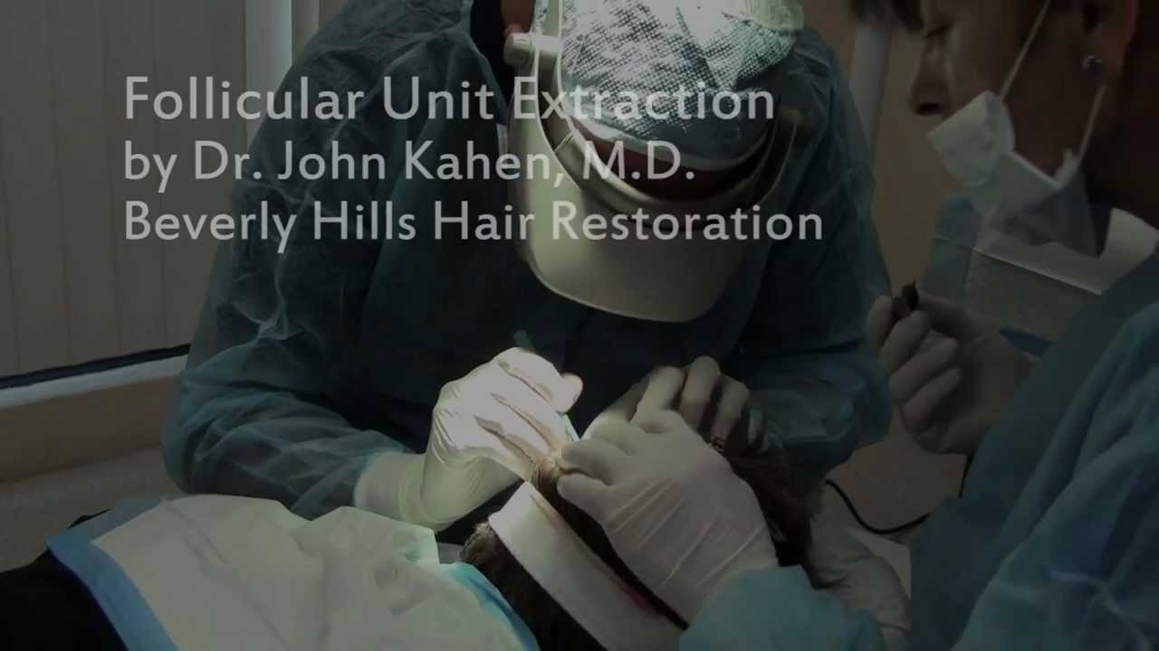 Los Angeles Hair Restoration FUE hair transplant procedure by Dr. John Kahen, M.D.