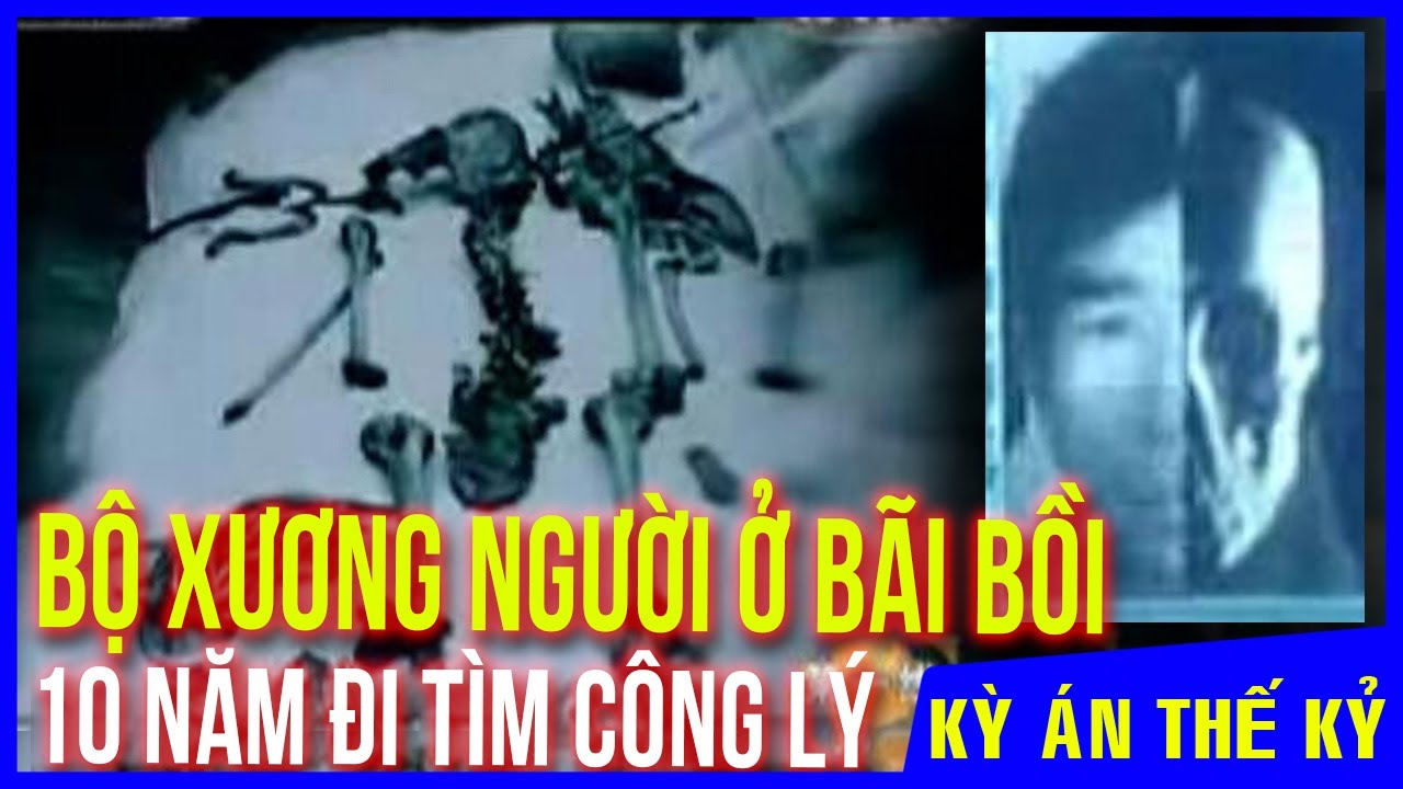 Kỳ Án #328 Bộ Xương Khô Trên Bãi Bồi Và Hành Trình 10 Năm Tìm Công Lý Của Người Phụ Nữ Đeo Khắn Tang