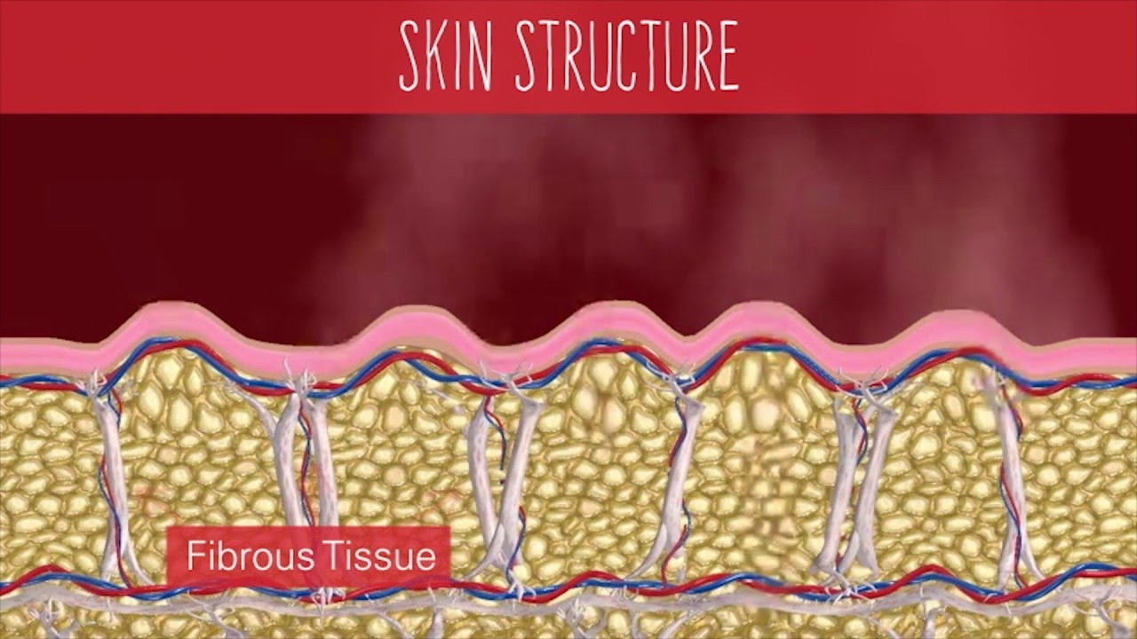 Cellfina - Cellulite Reduction | Dr. Jaime Schwartz MD, FACS