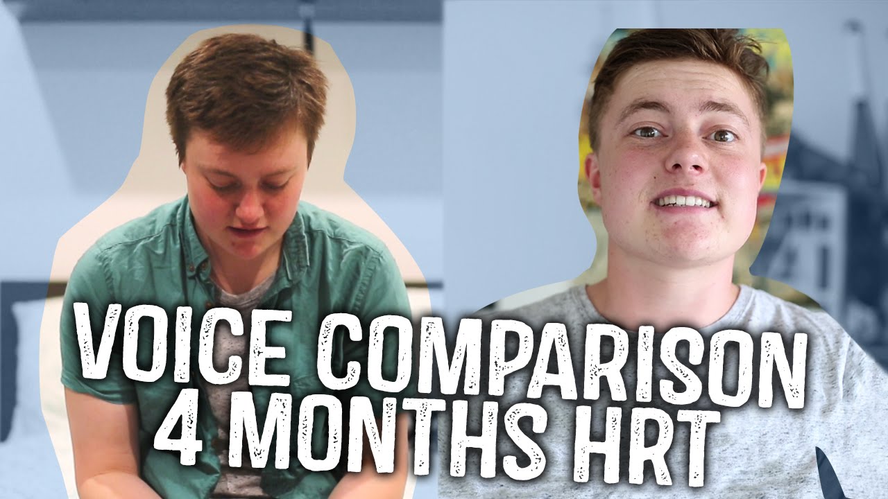 FTM Voice Drop! | 4 Months on Testosterone