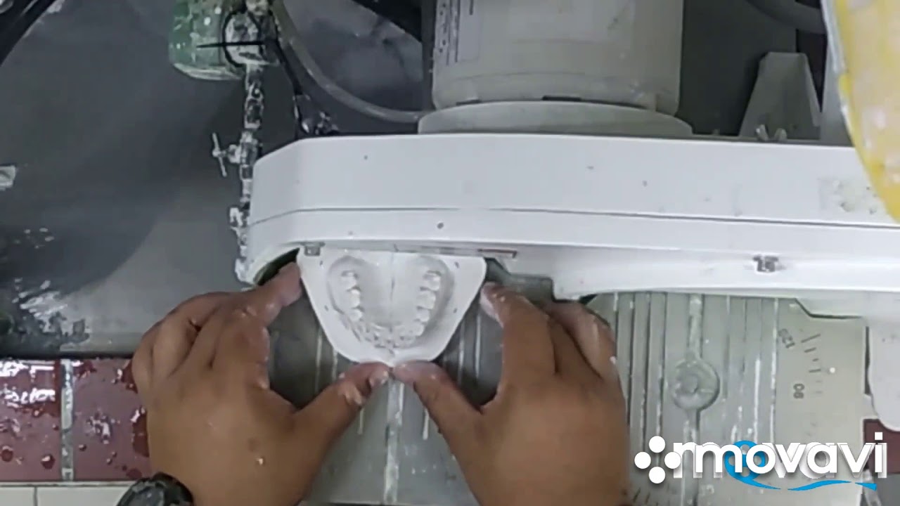 Study model Orthodontics fabrication