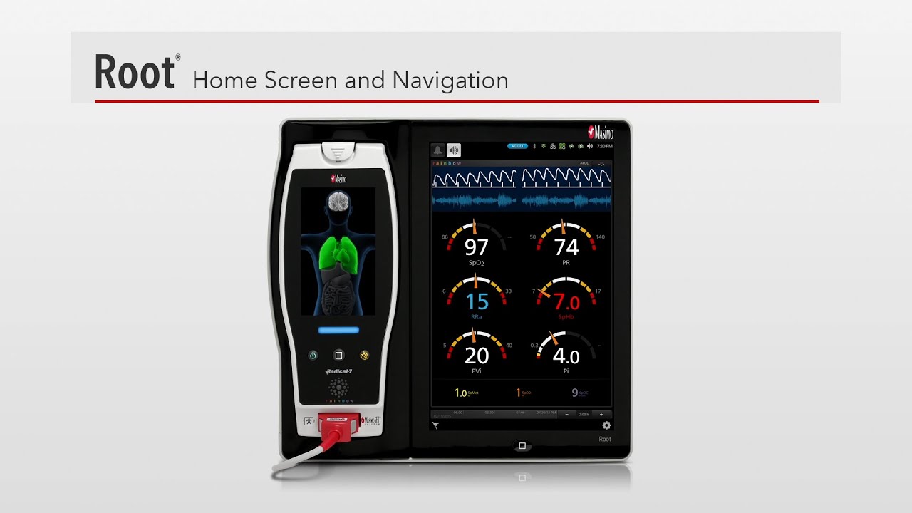 How To: Root®, a Patient Monitoring and Connectivity Platform, Home Screen and Navigation