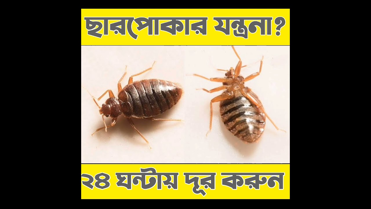 ছারপোকার সমস্যায় আছেন ? ছারপোকা থেকে স্থায়ী মুক্তি চান ?