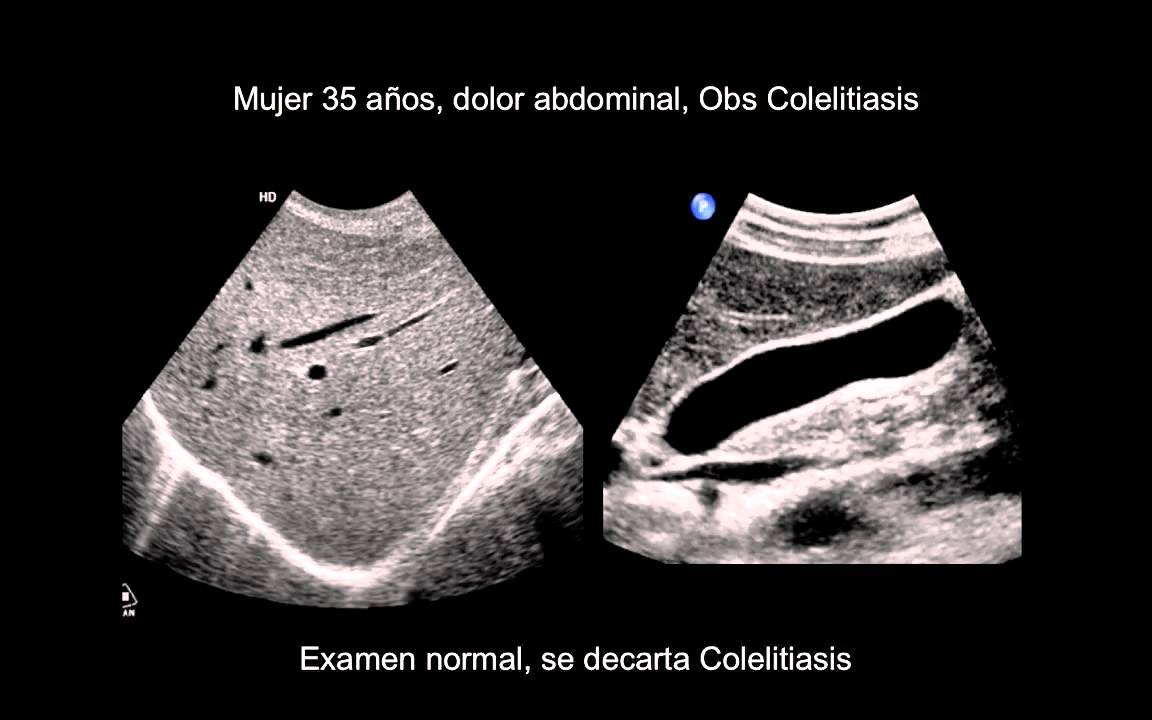 Generalidades de Radiología Abdominal II