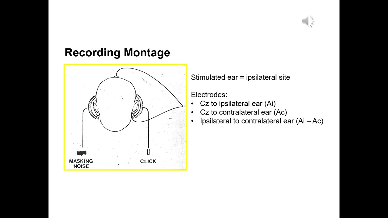 B2 BAEP theory   practical aspects