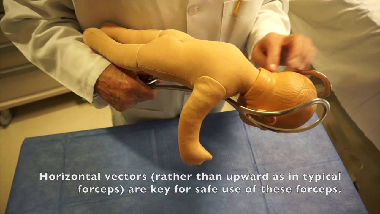 Which Forceps!?