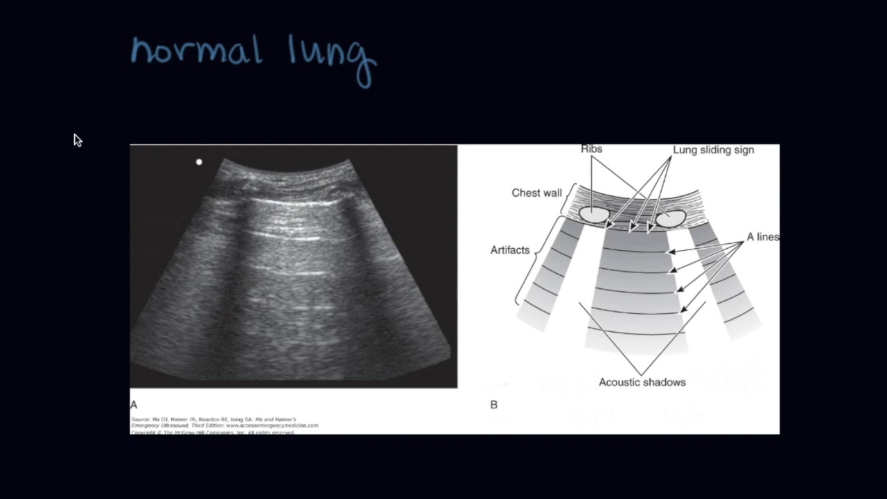 Ultrasound of the equine thorax