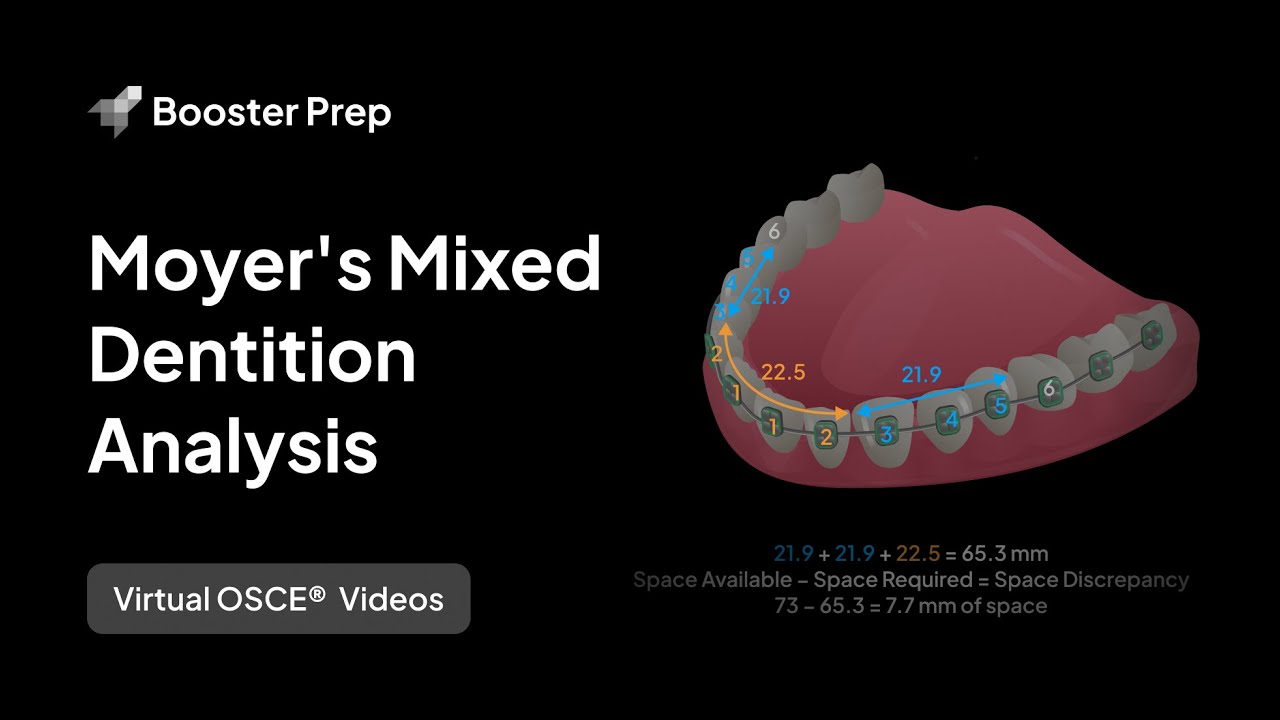 Moyer's Mixed Dentition Analysis | NDEB Virtual OSCE®