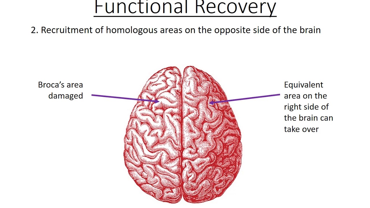 3.  Brain Plasticity