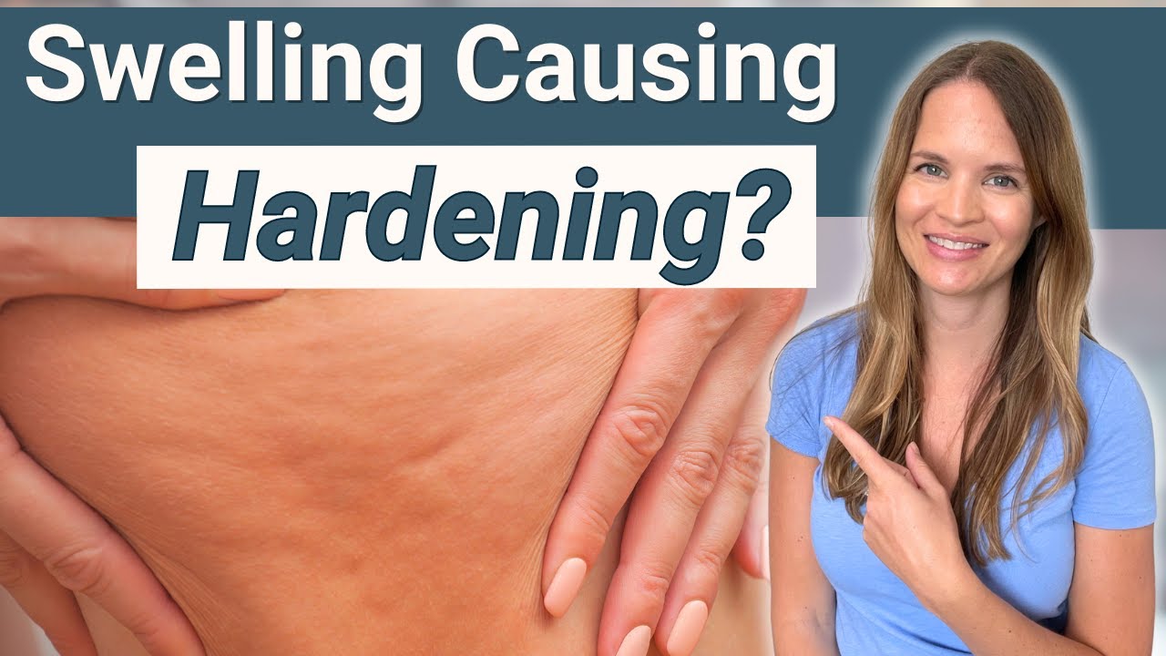 What is Fibrosis from Swelling?