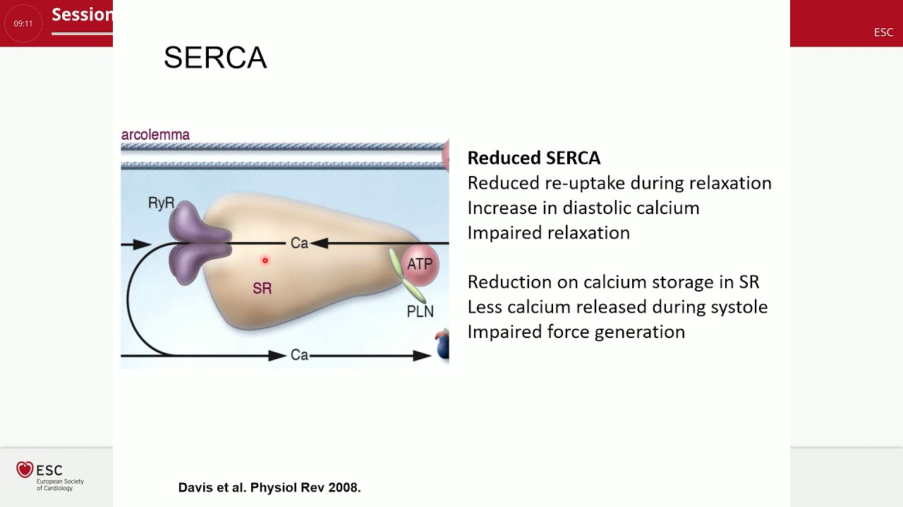 Pathophysiology of HFpEF, HFrEF, and HFmEF
