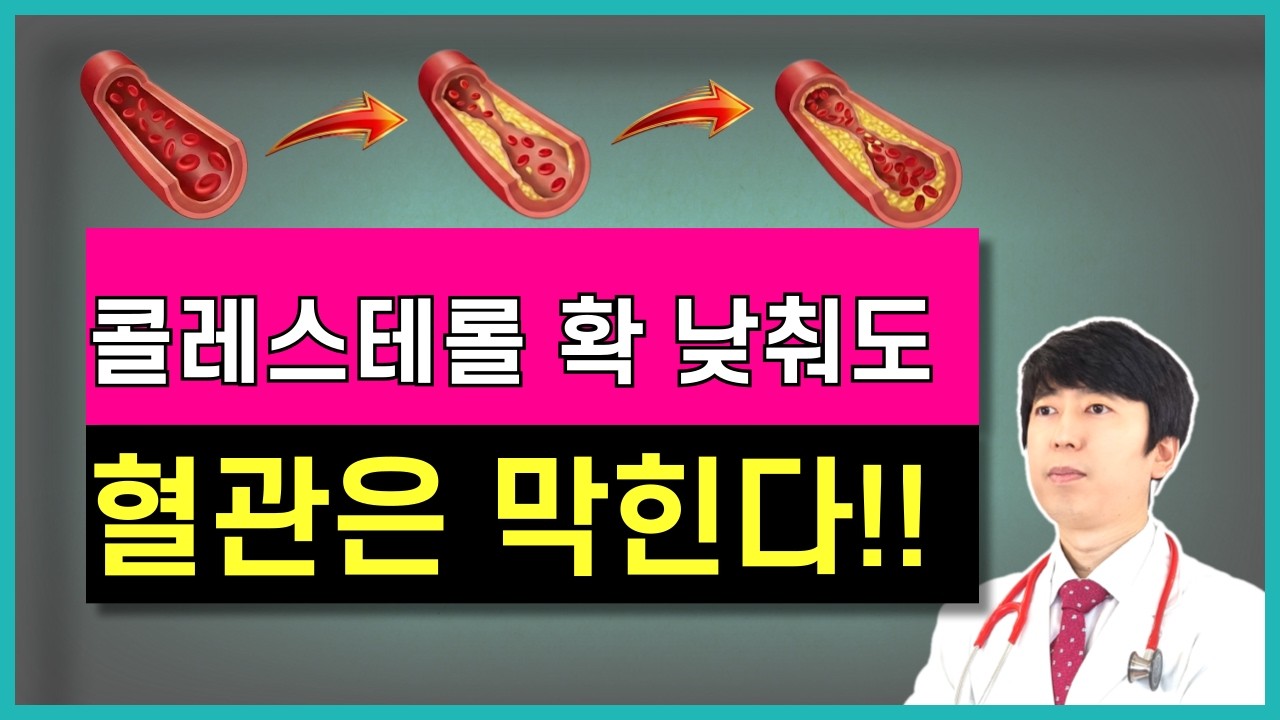 아무리 열심히 약 먹고 콜레스테롤 낮춰도 혈관은 막힙니다. 콜레스테롤이 아니라 이것을 낮춰야 혈관이 건강합니다. 고지혈증약 없이 콜레스테롤 고지혈증 치료하는 제대로 된 방법。