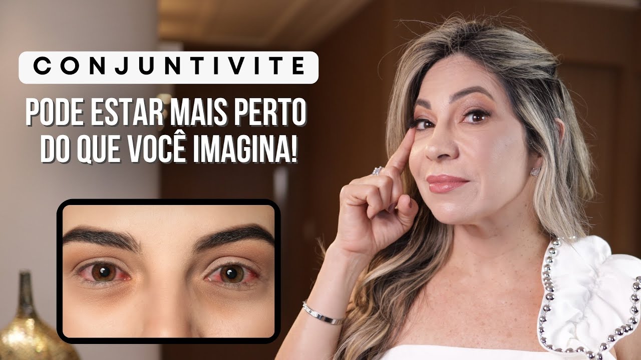 Conjuntivite: Jamais Fa&ccedil;a&nbsp;Isso!
