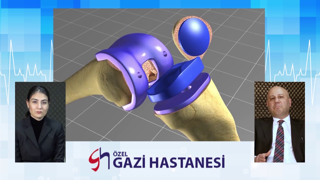 Diz Protezi Ameliyatı - Op.Dr. Mehmet Zeki ÖZCAN - Gazi Hastanesi