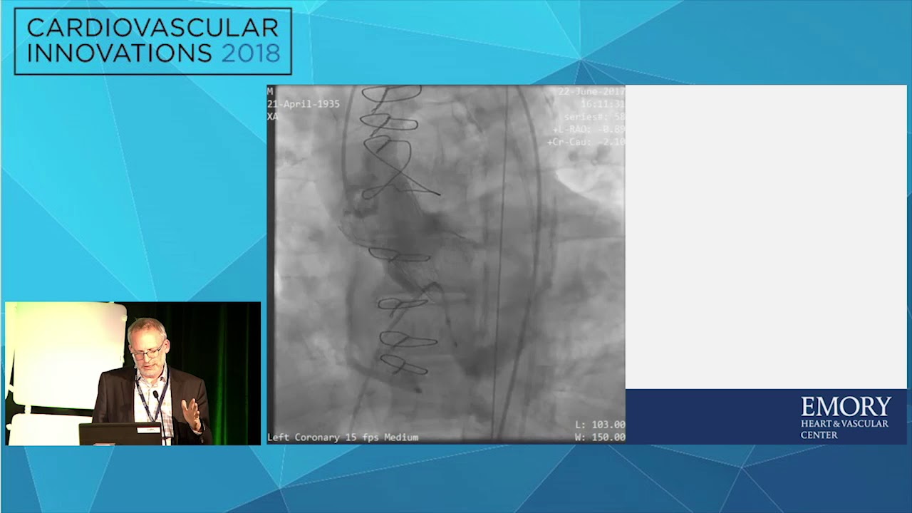 CVI2018 Session: Difficult transcaval therapy - Adam Greenbaum, MD