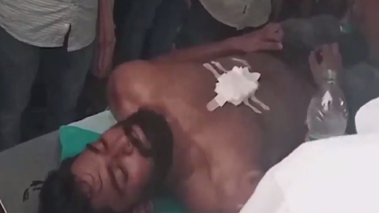 അഖിലിന്റെ ആരോഗ്യനിലയിൽ പുരോഗതി, അപകട നില തരണം ചെയ്തു| University college Akhil SFI attack